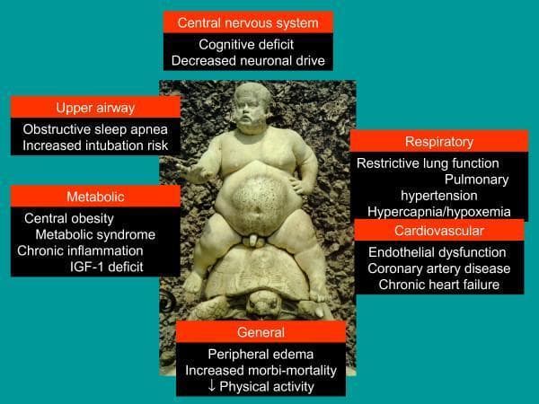 This infographic combines a clinical photograph of a historical statue (Bacchus in Boboli Gardens) with descriptive text boxes to illustrate the systemic consequences of obesity and Obesity Hypoventilation Syndrome (OHS). The central visual features a male figure with morbid obesity, characterized by significant central abdominal fat, subcutaneous fat around the thorax and thighs, and visible skin folds, seated on a tortoise. Surrounding the figure are clinical annotations categorized by organ system: 'Central Nervous System' (cognitive deficit, decreased neuronal drive), 'Upper Airway' (obstructive sleep apnea, intubation risk), 'Metabolic' (metabolic syndrome, chronic inflammation, IGF-1 deficit), 'Respiratory' (restrictive lung function, pulmonary hypertension, hypercapnia/hypoxemia), 'Cardiovascular' (endothelial dysfunction, coronary artery disease, chronic heart failure), and 'General' (peripheral edema, decreased physical activity, increased morbi-mortality). This educational illustration serves as a pathophysiology diagram to visualize the multi-organ impact of excessive body mass and respiratory system mechanical disturbance in the context of chronic pulmonary medicine.