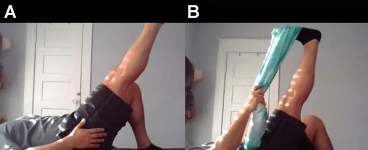 Two-panel clinical photograph demonstrating the self-administered Straight Leg Raise (SLR) test and the Bragard test, commonly used to assess for lumbar radiculopathy or disc pathology. Panel A shows a patient in the supine position with the right knee flexed and the left leg extended and elevated, simulating a modified straight leg raise. The patient’s hands are positioned on the hip and thigh for stabilization. Panel B illustrates the Bragard test modification, where the patient uses a teal-colored strap or cloth looped around the forefoot of the elevated leg to perform passive ankle dorsiflexion while maintaining the leg in an elevated position. This maneuver increases dural tension on the sciatic nerve and its roots. The images are likely from a telemedicine or home-based rehabilitation context, illustrating how orthopedic physical examination signs can be elicited by the patient. These tests are clinically relevant for diagnosing sciatica or lumbar nerve root irritation, where a positive result is defined by the reproduction of radicular pain.