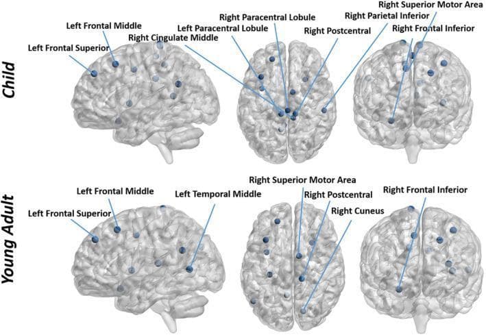 This diagnostic comparison chart utilizes fMRI-derived 3D brain network visualizations to illustrate functional hub regions across two developmental stages: Child (top row) and Young Adult (bottom row). The data is presented in sagittal, axial, and coronal views. Blue spheres represent detected network hubs mapped onto anatomical cortical regions. In the sagittal view, both groups share hubs in the Left Frontal Superior and Left Frontal Middle regions, though children uniquely show a hub in the Right Cingulate Middle. The axial view reveals significant age-related shifts: the child brain features hubs in the bilateral Paracentral Lobules, whereas the young adult brain displays hubs in the Right Superior Motor Area, Right Postcentral gyrus, and Right Cuneus. In the coronal view, the child group shows a wider hub distribution including the Right Parietal Inferior and Right Superior Motor Area, while the young adult group exhibits a more concentrated cluster in the Right Frontal Inferior region. This comparison demonstrates the maturation of functional connectivity networks (FCN), highlighting how hub locations stabilize and shift during brain development from childhood to young adulthood.