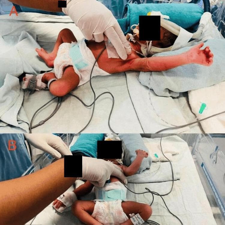 Hugging Face pmc clinical VQA raw