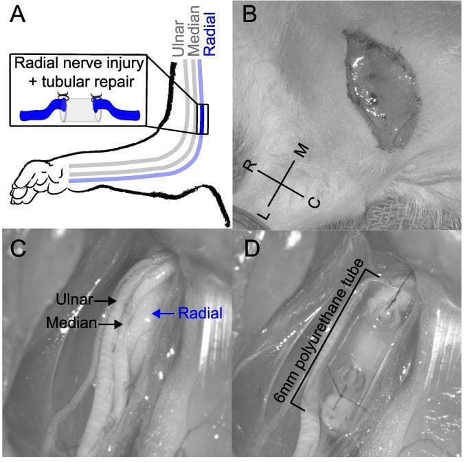 A multi-panel series illustrating a peripheral nerve injury and repair procedure in an animal model (rat forelimb), used for neuroanatomical and microsurgical education. Panel A is a schematic diagram showing the anatomical pathway of the ulnar, median, and radial nerves in the right forelimb, with an inset detailing a tubular nerve repair technique. Panel B shows a clinical photograph of a skin incision proximal to the elbow with orientation markers (R-L, M-C). Panel C provides a high-magnification intraoperative view of the isolated ulnar, median, and radial nerves, with the radial nerve specifically targeted for intervention. Panel D demonstrates the microsurgical tubular repair of a completely transected radial nerve. The proximal and distal nerve stumps are shown sutured 1 mm into the opposite ends of a 6-mm saline-filled polyurethane tube, leaving a 4-mm internal gap. This visual serves to demonstrate experimental peripheral nerve regeneration models, microsurgical suturing techniques, and the use of conduit-based bridging for segmental nerve defects.