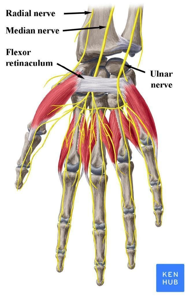 An anatomical illustration of the human hand and wrist (anterior palmar view), highlighting the peripheral nerves and the carpal tunnel. The image depicts the skeletal structure of the carpus, metacarpals, and phalanges, overlaid with musculature and major nerves in yellow. Key structures are labeled: the median nerve is shown passing deep to the flexor retinaculum (transverse carpal ligament), demonstrating its entry into the carpal tunnel. The ulnar nerve is positioned medially (ulnar side), passing superficial to the flexor retinaculum, while the superficial branch of the radial nerve is shown laterally near the radius. Distal to the wrist, the nerves are shown branching into digital nerves to provide sensory and motor innervation to the fingers. This diagram is clinically relevant for explaining the pathophysiology of Carpal Tunnel Syndrome, where the median nerve undergoes compression beneath the flexor retinaculum. Target audience: medical students and clinicians studying upper limb anatomy and entrapment neuropathies.