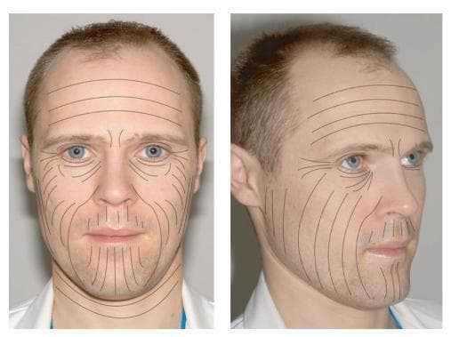 Hugging Face pmc clinical VQA raw