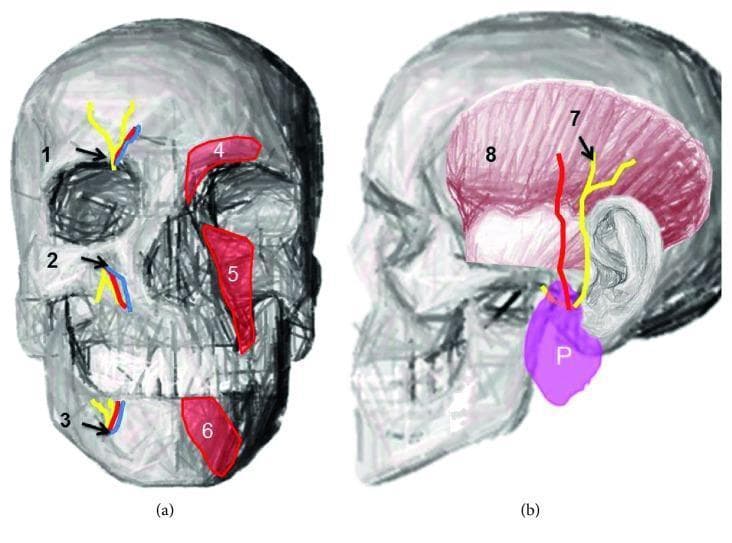 Anatomical diagrams of the human skull illustrating terminal branches of the trigeminal nerve and associated facial structures. Figure (a) is an anterior view highlighting the supraorbital notch (1), infraorbital foramen (2), and mental foramen (3), with accompanying neurovascular bundles shown in yellow (nerves) and blue/red (vessels). The diagram also depicts the overlying musculature: the corrugator supercilii (4), levator labii superioris (5), and depressor labii inferioris (6). Figure (b) provides a lateral view demonstrating the course of the auriculotemporal nerve (7) emerging from the parotid gland (P) and ascending across the temporal region. The temporalis muscle (8) is shown in pink, providing anatomical context for nerve distribution. This educational illustration demonstrates the relationship between bony landmarks, superficial facial muscles, and the sensory nerve exits essential for clinical procedures such as regional nerve blocks and the management of trigeminal neuralgias.