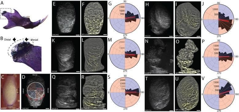 This composite educational image illustrates quantitative orientation analysis of the mandibular condylar cartilage (MCC) using Second Harmonic Generation (SHG) microscopy to track the progression of Temporomandibular Joint Osteoarthritis (TMJ-OA). Panels A-D define the anatomical orientation, showing the mesiodistal and mediolateral axes of the mandibular condyle. The main data displays (E-V) present a longitudinal comparison between non-surgical controls, a 16-week sham-control, and post-injury time points (4, 8, 12, and 16 weeks). Each time point features three representations: raw SHG scans (E, H, K, N, Q, T) showing fibrillar collagen; band-pass filtered SHG reconstructions (F, I, L, O, R, U) providing enhanced visualization of extracellular matrix (ECM) organization; and rose plots (G, J, M, P, S, V) quantifying vector orientations. The series demonstrates early-stage ECM remodeling at 4-8 weeks, followed by severe structural degradation at 12-16 weeks, characterized by visible fibrillations, fissures, and clefts in the superficial layer. The rose plots specifically show shifts in mean collagen fiber orientation (red line) and variance, with 180° indicating a mediolateral vector orientation.