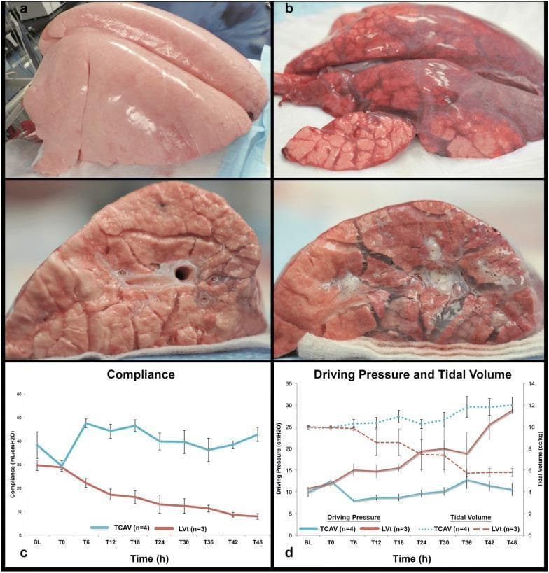 This educational image presents a comparison between two mechanical ventilation strategies—Time-Controlled Adaptive Ventilation (TCAV) and ARDSNet Low Tidal Volume (LVt) ventilation—in a 48-hour porcine model of Acute Respiratory Distress Syndrome (ARDS).
Panels A and B show gross lung photographs and cross-sections. The TCAV-treated lung (a) exhibits a healthy, light pink, well-inflated appearance with a smooth pleural surface and minimal edema. In contrast, the ARDSNet LVt-treated lung (b) shows severe acute lung injury, characterized by a dark red, mottled, and congested appearance with visible atelectasis and significant pulmonary edema.
Panels C and D provide quantitative physiological data over a 48-hour period. Graph C demonstrates that Respiratory System Compliance (CRS) remains stable and improves with TCAV, while it progressively declines with the LVt method. Graph D shows that TCAV maintains low Driving Pressure (ΔP) even as Tidal Volume (Vt) increases, whereas the LVt group experiences a sharp rise in ΔP despite decreasing Vt. This illustrates the lung-protective efficacy of TCAV in maintaining alveolar recruitment and mechanical stability compared to conventional low-volume strategies.