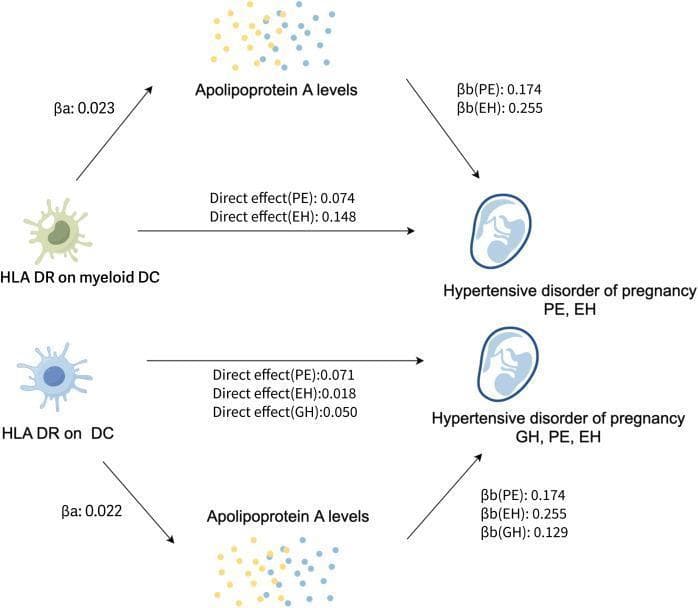 This pathophysiology diagram illustrates proposed causal pathways in the pathogenesis of Hypertensive Disorders of Pregnancy (HDP), specifically Pre-eclampsia (PE), Essential Hypertension (EH), and Gestational Hypertension (GH). The diagram is divided into two parallel signaling pathways demonstrating the relationship between HLA DR expression on Dendritic Cells (DCs) and HDP outcomes, mediated by Apolipoprotein A (apoA) levels. The top pathway shows 'HLA DR on myeloid DC' having both a direct effect on PE (0.074) and EH (0.148) and an indirect effect mediated through apoA levels. The bottom pathway shows 'HLA DR on DC' with direct effects on GH, PE, and EH, alongside a mediated pathway through apoA. Numerical beta values (βa and βb) quantify the causal associations at each node. Representative icons include a dendritic cell, a cluster of dots for apoA levels, and a stylized fetal/placental icon representing HDP. This infographic serves as a summary of Mendelian Randomization and mediation analysis results in obstetric immunology research.