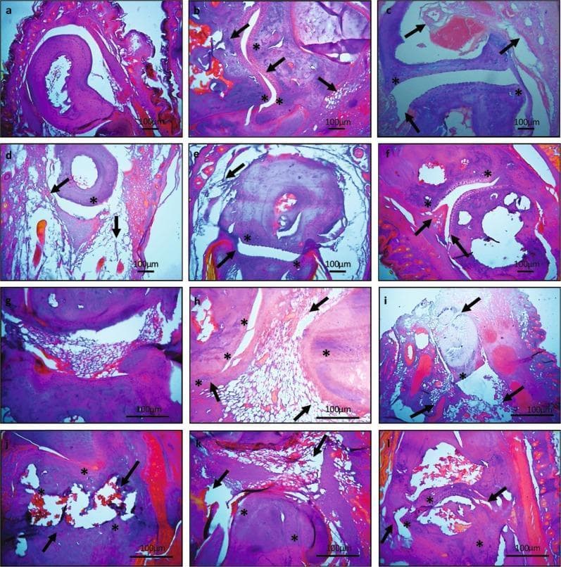 This composite diagnostic image consists of twelve light microscopy panels (a-l) showing hematoxylin and eosin (H&E) stained sections of mouse tarsal (a-f) and ankle (g-l) joints. The image serves as a comparison chart for rheumatoid arthritis pathology and treatment efficacy. Panels 'a' and 'g' represent normal controls, displaying intact articular cartilage, smooth synovial linings, and clear joint spaces. Panels 'b' and 'h' depict untreated arthritic joints, characterized by significant pannus formation, continuous cartilage degradation, bone erosion (indicated by arrows), and dense inflammatory cellular infiltration (marked by asterisks). Subsequent panels (c-f and i-l) illustrate the histological effects of various interventions, including hydroxychloroquine, leflunomide, and experimental plant extracts (aqueous and ethyl acetate). These panels demonstrate varying degrees of therapeutic response, ranging from persistent joint modification and bone loss in standard drug groups to preserved joint architecture and reduced synovial hyperplasia in extract-treated groups. The magnification (20x and 40x) allows for the visualization of key pathophysiological markers such as cellular infiltration, joint space narrowing, and osteoclast-mediated erosion.