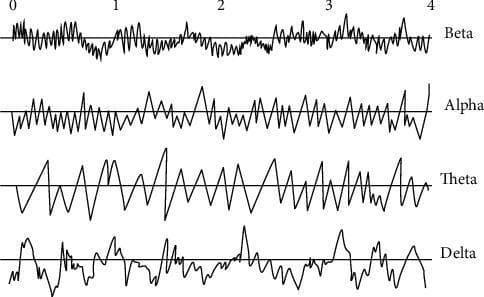 This diagnostic diagram illustrates the four primary temporal waveforms of electroencephalography (EEG) signal recording: Beta, Alpha, Theta, and Delta waves. Each waveform is displayed on a horizontal timeline from 0 to 4 seconds, demonstrating the relationship between frequency and amplitude. The Beta wave (13–30 Hz) shows the highest frequency with low-amplitude, rapid oscillations, typical of active concentration or an awake patient with open eyes. The Alpha wave (8–12 Hz) displays a slightly lower frequency with more rhythmic, synchronized peaks. The Theta wave (4–7 Hz) exhibits a further reduction in frequency with a regular, sawtooth-like pattern, often associated with deep relaxation or light sleep. The Delta wave (0.5–4 Hz) presents the lowest frequency with slow, high-amplitude irregular oscillations, characteristic of deep sleep or anesthesia. This comparison chart is essential for clinical neurophysiology to distinguish between different stages of consciousness, sleep, and neurological states based on cortical electrical activity.