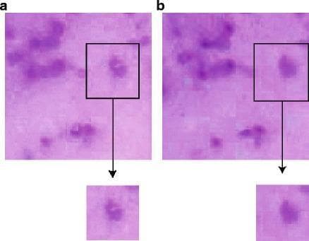 This Comparison Chart displays two panels of Giemsa-stained thick blood film microscopy, labeled 'a' (left) and 'b' (right), demonstrating the effects of color consistency correction on Extended Depth of Field (EDoF) composite images. The images depict dark purple foreground objects, representing cells or malarial parasites (Plasmodium species), against a light pink/lavender background. Panel 'a' serves as the pre-correction baseline, exhibiting visible shading aberrations and color inconsistencies where pixels from different focal planes have been merged. Black bounding boxes with magnified insets highlight these artifacts, showing uneven distribution of color within the cellular structures. Panel 'b' shows the results after applying a 5x5 filtering mask for color correction. The magnified inset in panel 'b' demonstrates improved color uniformity, reduced shading artifacts, and sharper edge definition of the foreground objects. This educational visual illustrates critical digital pathology preprocessing steps necessary for automated malaria diagnosis and pattern recognition, where consistent color and contrast are essential for accurate object identification.