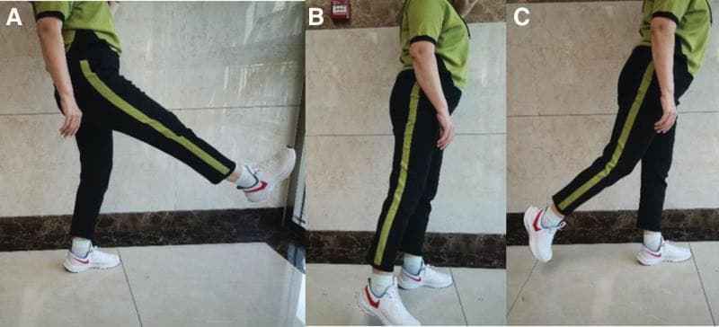 A series of three clinical photographs (labeled A, B, and C) demonstrating a sagittal plane leg swing exercise, a physical therapy technique used in the management of knee osteoarthritis (KOA). The images show a patient standing on an unaffected leg while performing active range-of-motion movements with the affected limb. (A) Depicts hip flexion, with the leg raised forward to approximately 45 degrees from the vertical axis. (B) Shows the leg in a neutral vertical position, slightly abducted to facilitate clearance during the swing. (C) Demonstrates hip extension, with the leg swinging posteriorly behind the coronal plane of the body. The exercise aims to improve joint mobility and periarticular muscle coordination. The standing posture remains relatively upright with a slight forward lean to maintain balance during the dynamic movement. This visual protocol serves as a rehabilitation guide for non-surgical conservative management of degenerative joint disease.