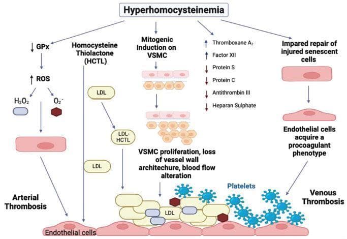 A pathophysiology diagram illustrating the mechanisms by which hyperhomocysteinemia induces endothelial damage, leading to arterial and venous thrombosis. The diagram flows from the central header 'Hyperhomocysteinemia' into five distinct pathways. The left pathway details oxidative stress, showing decreased Glutathione Peroxidase (GPx) and increased Reactive Oxygen Species (ROS), such as H2O2 and O2-, leading to arterial thrombosis. A second pathway shows Homocysteine Thiolactone (HCTL) interacting with LDL. The central 'Mitogenic Induction' pathway depicts vascular smooth muscle cell (VSMC) proliferation and loss of vessel wall architecture. A fourth pathway lists hematologic alterations, specifically increased Thromboxane A2 and Factor XII, alongside decreased Protein S, Protein C, Antithrombin III, and Heparan Sulphate. The right pathway illustrates impaired repair of injured senescent cells and the acquisition of a procoagulant phenotype. The bottom of the diagram shows a damaged endothelial layer with adherent LDL and platelets, visually differentiating the mechanisms that culminate in arterial versus venous thrombotic events.