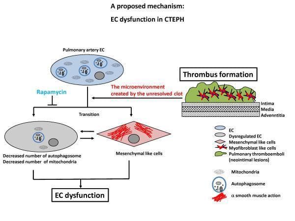 This pathophysiology diagram illustrates a proposed mechanism for endothelial cell (EC) dysfunction in Chronic Thromboembolic Pulmonary Hypertension (CTEPH). The process originates with 'Thrombus formation,' showing pulmonary thromboemboli (neointimal lesions) atop the intima, media, and adventitia layers of the vascular wall. This creates a microenvironment influenced by the unresolved clot, which acts upon pulmonary artery ECs. The schematic depicts two primary pathways for EC transformation: 1) Transition into 'Mesenchymal like cells' (Endothelial-to-Mesenchymal Transition/EnMT), characterized by a spindle shape and red filaments representing α-smooth muscle actin, and 2) transformation into 'Dysregulated ECs,' identified by a decreased number of autophagosomes and mitochondria. Both pathways converge to result in 'EC dysfunction.' The drug Rapamycin is shown as an inhibitory agent blocking the pathway toward dysregulated ECs. A detailed legend identifies cellular components including myofibroblast-like cells, mitochondria (small blue ovals), and autophagosomes (double-membrane circular structures). This diagram serves as an educational summary of how chronic clots contribute to pulmonary vascular remodeling and metabolic cellular defects.