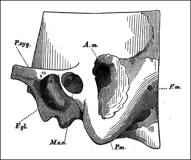 This historical anatomical diagram illustrates a lateral view of the temporal bone, specifically demonstrating a mastoidectomy procedure. The diagram depicts the mastoid process (P.m.) after a surgical opening has been created to expose the mastoid antrum (A.m.). Key landmarks include the external auditory meatus (M.a.e.) located inferior to the antrum, the zygomatic process (P.zyg.) extending anteriorly, and the glenoid fossa (F.g.l.) which accommodates the mandibular condyle. Posterior to the surgical site, the foramen of the mastoid vein (F.m.) is visible. The illustration highlights the orientation of the surgical access point, situated superior to the ear canal and inferior to the temporal line, which serves as a traditional landmark for accessing the middle ear air cell system. This technical drawing is pedagogically significant for understanding the early development of otologic surgical techniques and the spatial relationships within the mastoid portion of the temporal bone.