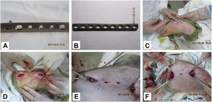 A series of clinical photographs and hardware images demonstrating orthopedic internal fixation. Panels (A) and (B) show the structural design of two 9-hole orthopedic plates: a Locking Compression Plate (LCP) with combination holes allowing for both locking and compression screws, and a Limited Contact Dynamic Compression Plate (LC-DCP) with uniform oblong holes designed to reduce bone-to-plate contact and protect periosteal blood supply. Panels (C) through (F) depict the surgical application of these plates on a femur using the Minimally Invasive Percutaneous Plate Osteosynthesis (MIPPO) technique. The images show small skin incisions, the insertion of the plates along the bone shaft using surgical forceps, and the subsequent fixation with screws through these limited portals. This visual material illustrates the comparative surgical approach and hardware characteristics used in veterinary orthopedic surgery, specifically focusing on femoral fracture management and the biological advantages of minimally invasive plate osteosynthesis over traditional open reduction.