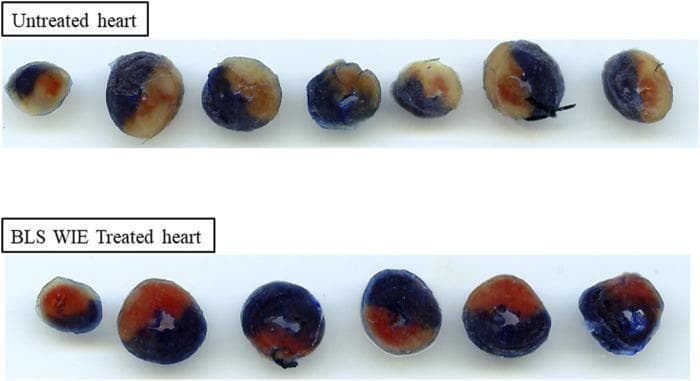 This clinical specimen image displays a series of transverse heart slices used to evaluate myocardial infarction size following ischemia-reperfusion injury. The slices are grouped into an 'Untreated heart' (top row) and a 'BLS WIE Treated heart' (bottom row). The specimens are double-stained using Evans Blue and Triphenyl Tetrazolium Chloride (TTC) to differentiate tissue viability. Three distinct zones are visible: 1) Dark blue areas represent viable, non-ischemic myocardium perfused by Evans Blue; 2) Deep red areas represent the 'Area at Risk' (AAR), which were ischemic but remain viable as indicated by TTC staining; 3) Unstained white or pale areas represent the infarcted tissue (IS) where necrosis has occurred. A visual comparison reveals that the BLS WIE treated hearts possess significantly smaller unstained white areas and a higher proportion of red-stained tissue compared to the untreated group. This illustrates the cardioprotective efficacy of the treatment in limiting infarct expansion and preserving myocardial tissue within the area at risk.