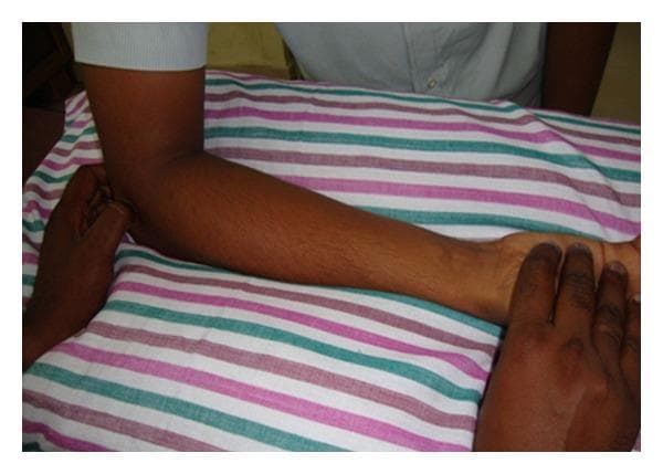 A clinical photograph demonstrating the application of Cyriax physiotherapy, specifically deep transverse friction massage (DTFM) for the management of lateral epicondylitis (tennis elbow). The patient's upper extremity is positioned in approximately 90 degrees of elbow flexion with the forearm fully supinated, resting on a flat surface. A therapist's hands are shown executing the technique: one hand stabilizes the distal forearm and wrist, while the other hand applies localized, deep transverse pressure to the teno-osseous junction at the lateral epicondyle of the humerus. This manual therapy intervention is designed to reduce pain and prepare the extensor carpi radialis brevis tendon for subsequent therapeutic maneuvers, such as Mill's manipulation. The image serves as a pedagogical reference for hand placement and patient positioning in orthopedic physical therapy.
