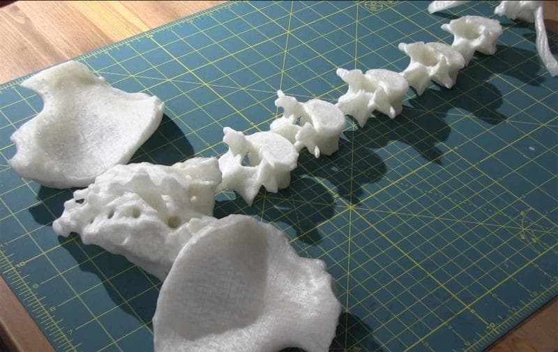 Anatomical Diagram/Specimen: This clinical photograph displays a collection of 3D-printed anatomical components intended for the construction of a lumbar neuraxial block task trainer. The specimens, printed in white polylactic acid (PLA) using fused filament fabrication (FFF), include individual lumbar vertebral bodies (T10 through L5), bilateral iliac crests, and the sacrum. The vertebral bodies are arranged linearly on a green cutting mat, showcasing detailed posterior elements including spinous and transverse processes. The iliac crests exhibit characteristic complex, irregular morphology and a porous surface texture typical of layer-by-layer 3D printing. These high-fidelity models, derived from CT DICOM data, serve as realistic palpable landmarks for medical simulation. The educational focus is on the spatial orientation of the lumbar spine, sacrum, and pelvis, highlighting their clinical relevance in anesthesiology for identifying entry points for epidural or spinal anesthesia.