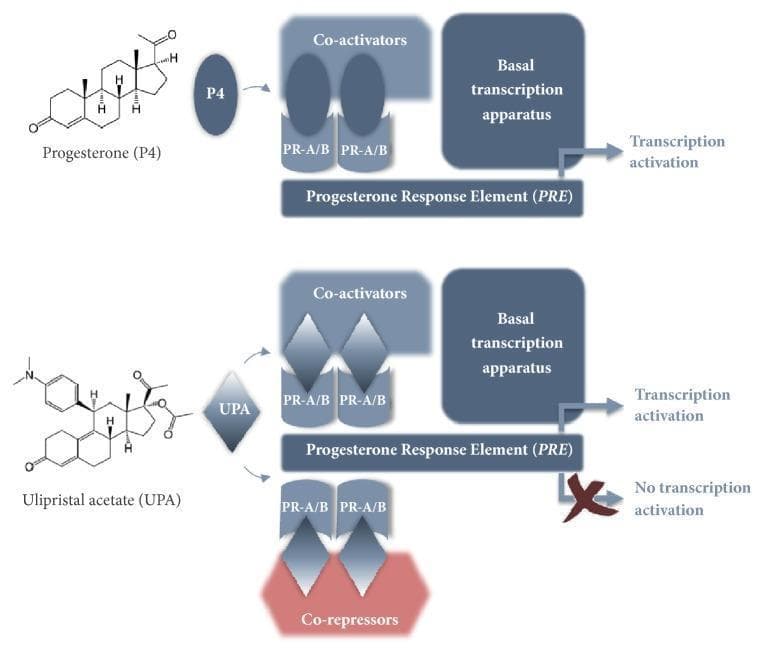 This pathophysiology diagram illustrates the molecular mechanism of action of Selective Progesterone Receptor Modulators (SPRMs) compared to Progesterone (P4). The upper panel depicts the natural ligand, Progesterone, binding to the Progesterone Receptor isoforms PR-A/B. This complex binds to the Progesterone Response Element (PRE) and recruits co-activators to the basal transcription apparatus, resulting in transcription activation. The lower panel displays the mechanism for Ulipristal Acetate (UPA), an SPRM used in the treatment of uterine fibroids. UPA binds to PR-A/B on the PRE; however, its unique chemical structure induces a conformational change that allows for the recruitment of both co-activators and co-repressors. The recruitment of co-repressors (indicated in red) inhibits the basal transcription apparatus, leading to the prevention of transcription activation, denoted by a red cross over the transcription arrow. This diagram highlights the mixed agonistic/antagonistic properties of SPRMs at the genomic level, which underpins their clinical efficacy in regulating endometrial and fibroid tissue proliferation.