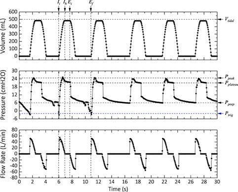 This diagnostic graphic displays three stacked ventilator waveforms (Volume, Pressure, and Flow Rate) over a 30-second interval, demonstrating mechanical ventilation in assisted mode. The top graph shows Tidal Volume (Vt) pulsing consistently to approximately 500 mL with a distinct plateau indicating an end-inspiratory hold. The middle Pressure-time waveform illustrates critical respiratory parameters: a negative deflection reaching the trigger pressure (Ptrig) of -2 cmH2O initiates each breath, followed by a rapid rise to a peak inspiratory pressure (Ppeak) of ~25 cmH2O. An inspiratory hold reveals a plateau pressure (Pplateau) of ~22 cmH2O, with the cycle concluding at a positive end-expiratory pressure (PEEP) of ~5 cmH2O. The bottom Flow Rate graph displays corresponding inspiratory and expiratory flow pulses. Annotations mark key temporal points: initial inspiration (Ii), inspiratory hold (Ih), end-inspiration (Ei), and end-expiration (Ef). This visualization is essential for understanding ventilator-patient synchrony, mechanical lung properties (compliance and resistance), and the functioning of pressure-triggered assisted ventilation modes.