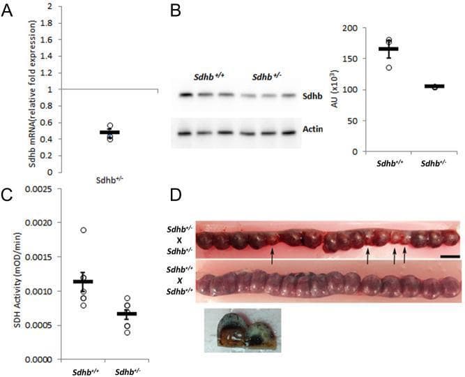 This composite educational image illustrates the molecular and developmental consequences of Sdhb (Succinate Dehydrogenase Complex Iron-Sulfur Subunit B) deletion in a rat model. Panel A: A scatter plot showing an approximately 50% reduction in Sdhb mRNA relative fold expression in heterozygous (Sdhb+/-) liver tissue compared to wild-type (Sdhb+/+), normalized to a baseline of 1. Panel B: An immunoblot (Western blot) and corresponding densitometric bar graph demonstrating reduced Sdhb protein expression in Sdhb+/- rats compared to Sdhb+/+ controls, using Actin as a loading control. Panel C: A scatter plot quantifying decreased SDH enzyme activity (mOD/min) in Sdhb+/- tissue. Panel D: A clinical macroscopic photograph of opened uteri from 12-day-old gravid rats. The top uterus (Sdhb+/- x Sdhb+/- cross) displays multiple developmentally stalled, smaller, and darker embryos (indicated by black arrows), illustrating the lethal effect of homozygous deletion. The bottom uterus (Sdhb+/+ x Sdhb+/+ cross) shows uniform, healthy embryonic development. This figure highlights the role of Sdhb in mitochondrial function and embryonic viability.