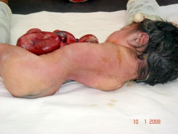 Hugging Face pmc clinical VQA raw