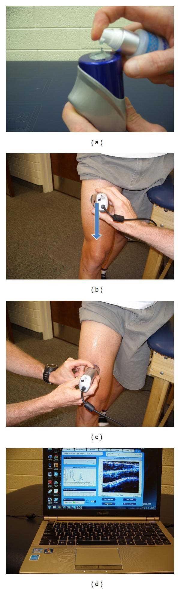 A series of four clinical photographs (a-d) demonstrating the procedural sequence for a musculoskeletal ultrasound scan of the human thigh, primarily used for body composition and tissue thickness assessment.