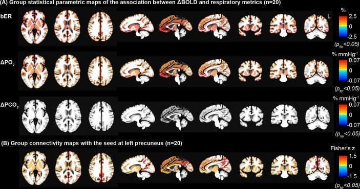 This diagnostic imaging figure presents a neuroimaging comparison using functional magnetic resonance imaging (fMRI) data from a group study (n=20). The image is divided into four rows of brain maps shown in axial, sagittal, and coronal planes. Row (A) displays group statistical parametric maps illustrating the association between Blood Oxygen Level-Dependent signal changes (ΔBOLD) and three respiratory gas exchange metrics: breath-by-breath Exchange Ratio (bER), partial pressure of oxygen (ΔPO2), and partial pressure of carbon dioxide (ΔPCO2). Heat maps (red-yellow indicating positive association) reveal significant coupling for bER and ΔPO2 across widespread cortical regions, particularly within the Default Mode Network (DMN), including the precuneus and posterior cingulate cortex. The association with ΔPCO2 is notably weaker and more localized. Row (B) shows a group functional connectivity map using a seed-based approach at the left precuneus. The spatial distribution of increased connectivity in the DMN highly correlates with the association patterns seen in the bER and ΔPO2 maps. Statistical significance is corrected at p_fdr < 0.05, demonstrating the relationship between systemic respiratory metrics and resting-state neural networks.