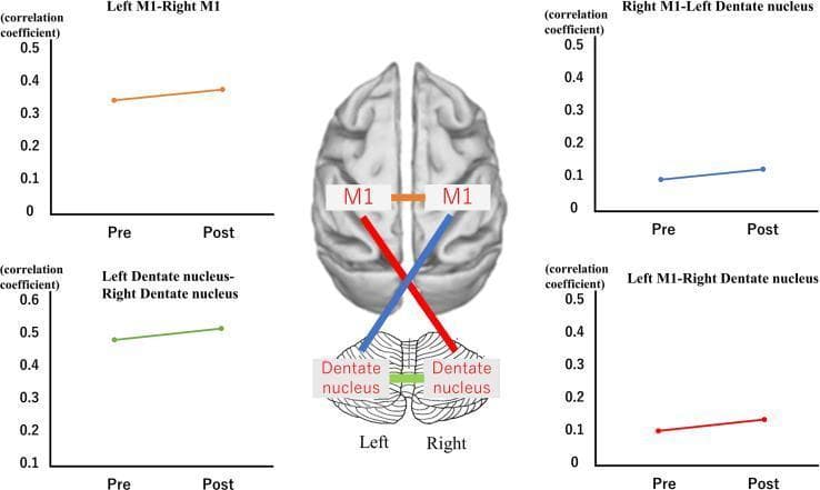 Educational medical graphic illustrating functional connectivity (FC) between the cerebral cortex and cerebellum, specifically the primary motor cortex (M1) and the dentate nuclei. A central anatomical diagram depicts a superior view of the brain and cerebellum with colored lines representing specific neural connections: orange for bilateral M1, green for bilateral dentate nuclei, blue for right M1 to left dentate nucleus, and red for left M1 to right dentate nucleus. Surrounding the diagram are four line graphs plotting the Fisher-transformed correlation coefficients during 'Pre' and 'Post' experimental phases. 1) Left M1-Right M1 shows an orange line increasing from ~0.34 to ~0.38. 2) Left Dentate-Right Dentate shows a green line rising from ~0.48 to ~0.51. 3) Right M1-Left Dentate shows a blue line rising from ~0.09 to ~0.12. 4) Left M1-Right Dentate shows a red line increasing from ~0.1 to ~0.14. This visualization characterizes the relationship between cortical motor areas and cerebellar nuclei, likely in the context of prism adaptation or motor learning research.