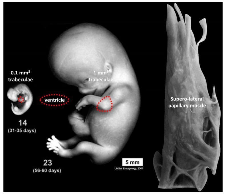 This educational image illustrates the morphological evolution of cardiac trabeculae and the ventricle across human embryonic development and into adulthood. The figure presents three distinct stages: a Carnegie stage 14 embryo (31-35 days), a Carnegie stage 23 embryo (56-60 days), and a high-resolution view of an adult supero-lateral papillary muscle. Dashed red lines on the embryos demarcate the cardiac ventricle, highlighting its growth. Quantitative annotations indicate that the volume of trabecular muscle increases by an order of magnitude from 0.1 mm3 at stage 14 to 1 mm3 at stage 23. The adult supero-lateral papillary muscle is shown as a complex, branching macroscopic structure, illustrating its developmental origin from the primitive embryonic trabecular network. The comparison emphasizes key concepts in embryology and cardiology, specifically the transition from a highly trabeculated embryonic ventricle to the specialized muscular structures of the mature heart, such as papillary muscles and the compacted ventricular wall.