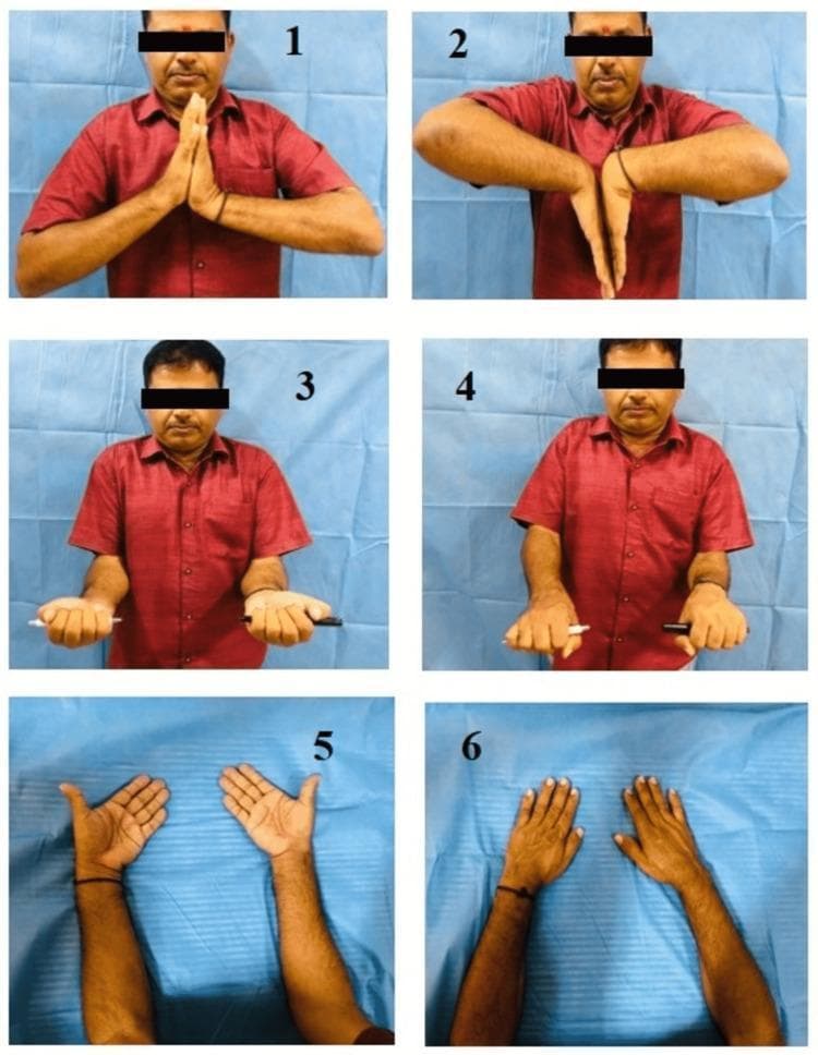 This composite of clinical photographs illustrates the standard functional range of motion (ROM) assessment for the wrist and forearm. The six panels depict a patient performing specific bilateral movements: 1. Dorsiflexion (extension) with palms pressed together; 2. Palmar flexion with the dorsal surfaces of the hands together; 3. Forearm supination with palms facing upward while holding pens to visualize rotational axis; 4. Forearm pronation with palms facing downward; 5. Ulnar deviation showing the hands angled away from the midline; and 6. Radial deviation showing the hands angled toward the midline. The images serve as an educational guide for orthopedic and physical therapy examinations, demonstrating the clinical evaluation of the radiocarpal and distal radioulnar joints. These maneuvers are essential for assessing joint mobility following distal radius fractures or other musculoskeletal injuries.