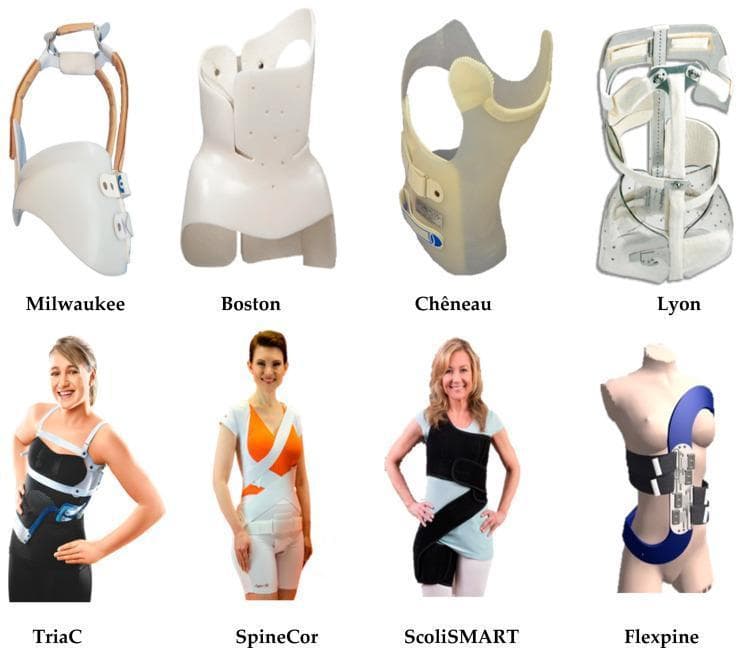 A comparison chart of rigid and soft spinal orthoses used in the non-surgical management of adolescent idiopathic scoliosis. The top row illustrates four types of rigid braces: the 'Milwaukee' brace featuring a pelvic girdle and neck ring connected by metal uprights; the 'Boston' brace, a low-profile thoracolumbosacral orthosis (TLSO); the 'Chêneau' brace, designed for three-dimensional correction; and the 'Lyon' brace, an adjustable multi-shell design. The bottom row demonstrates soft or flexible corrective devices as worn by patients or mannequins: the 'TriaC' brace with semi-rigid components; the 'SpineCor' system utilizing elastic bands; the 'ScoliSMART' suit; and the 'Flexpine' orthosis which employs a tension-based strap mechanism. This visual provides an educational overview of the structural evolution in orthopedic technology, moving from high-profile rigid frames to low-profile, flexible, and dynamic bracing systems aimed at improving patient compliance and mobility while arresting spinal curve progression.