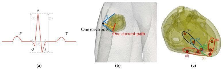 Educational diagram illustrating ECG waveform parameters and cardiac electrophysiological modeling. Panel (a) shows a standard ECG trace with labels for the P wave, QRS complex (Q, R, and S waves), and T wave. Numerical annotations indicate (1) signal amplitude (SA), (2) R-wave amplitude, and (3) QRS complex width. Panel (b) depicts a 3D anatomical thorax model showing the geometric relationship between a surface electrode and the heart's current path; it defines distance 'd' and the solid angle 'θ' subtended by the heart. Panel (c) provides an isolated view of the heart's conduction system, mapping sequential signal propagation from the A-V node and bundle of His (4-5) through the bundle branches (6) to the Purkinje fibers (7-8) using electric dipoles. This figure serves to bridge the gap between cardiac anatomy, the physics of volume conduction, and the resulting clinical electrocardiographic signals.
