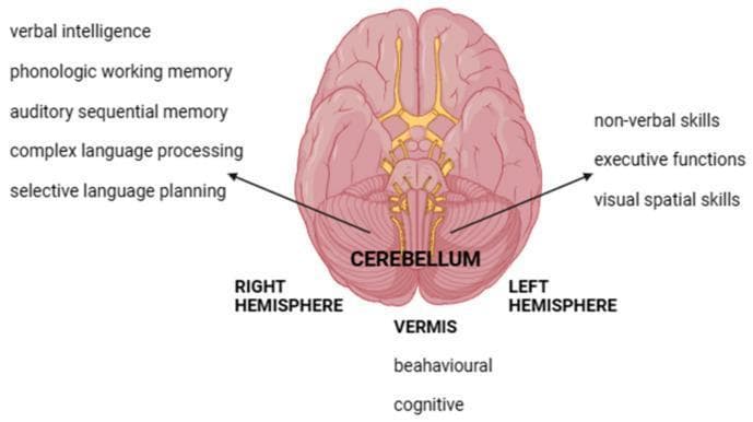 This medical anatomical diagram illustrates the functional neuroanatomy of the human cerebellum from an inferior view. The diagram highlights the division of the cerebellum into the Right Hemisphere, Left Hemisphere, and the midline Vermis. It serves as an educational infographic detailing the lateralization of cerebellar functions. The Right Hemisphere is annotated with language-related and verbal tasks, including verbal intelligence, phonologic working memory, auditory sequential memory, complex language processing, and selective language planning. Conversely, the Left Hemisphere is associated with non-verbal skills, executive functions, and visual spatial skills. The midline Vermis is linked to behavioral and cognitive regulation. The visual includes a simplified representation of the brain's ventral surface, including the brainstem and cranial nerve origins, emphasizing the cerebellum's role in the Cerebellar Cognitive Affective Syndrome (CCAS). This material is designed for neurology and neuropsychology education, illustrating the functional consequences of localized cerebellar lesions.