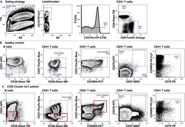 This diagnostic image displays multiparametric flow cytometry contour plots illustrating the immunophenotypic signature of Common Variable Immunodeficiency (CVID), specifically the 'AcT' cluster. The panel is organized into three rows: (A) Initial gating strategy for lymphocytes, CD19+ B cells, and CD3+ T cells; (B) Healthy control reference; and (C) CVID AcT patient profile. Key diagnostic hallmarks highlighted in red boxes for the AcT patient include a significant expansion of CD21low B cells (CD21-APC vs CD38-Alexa 700) and a shift in CD4+ T cell differentiation. Specifically, the patient shows a depletion of naive T cells (CD27+CD45RA+) and an expansion of intermediate memory T cells (CD27-CD28+). Additional plots demonstrate increased expression of senescence and activation markers, such as CD279 (PD-1), CD57, and CD70, in the patient's CD4+ T cell compartment. This visual comparison emphasizes the 'immunophenotypic aging' and chronic activation characteristic of certain CVID subsets, facilitating clinical classification and pathophysiological study of primary immunodeficiencies.