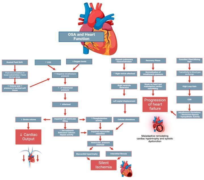 A complex pathophysiology flowchart titled 'OSA and Heart Function' detailing the multi-pathway effects of Obstructive Sleep Apnea on cardiac health. The diagram starts with primary drivers including rostral fluid shift (causing cervical soft tissue pressure), hypercapnia (↑CO2), and hypoxia (↓oxygen levels). These lead to increased negative intrathoracic pressure, which elevates left ventricular (LV) transmural pressure and afterload. Resulting impaired LV filling leads to decreased stroke volume and cardiac output. Another pathway describes how hypoxic pulmonary vasoconstriction increases right ventricle (RV) afterload, causing RV distension and left septal displacement. These hemodynamic stresses, combined with cellular alterations (increased phospholamban activity and decreased SERCA activity), lead to impaired myocardial relaxation, ventricular pressure overload, myocardial hypertrophy, and interstitial fibrosis. The flowchart culminates in major clinical outcomes: 'Progression of Heart Failure' and 'Silent Ischemia,' categorized as maladaptive cardiac remodeling and systolic/diastolic dysfunction. Additional loops include the impact of high loop gain and Cheyne-Stokes respiration (CSR) on sympathetic activity and nocturnal hypoxia.