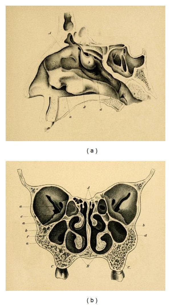 This historical anatomical diagram by Emil Zuckerkandl (1882) illustrates the paranasal sinuses and nasal anatomy in two planes. Image (a) is a sagittal section of the nasal cavity, detailing the complex arrangement of the superior, middle, and inferior turbinates (conchae) along the lateral wall. It visualizes the frontal sinus superiorly, the sphenoid sinus posteriorly, and the relationship between the nasal cavity and the hard palate. Image (b) presents a frontal (coronal) section, showcasing the bilateral symmetry of the mid-facial anatomy. Key features include the central nasal septum, the convoluted turbinates projecting into the nasal passages, and the expansive maxillary sinuses situated laterally within the maxilla bones. Small ethmoid air cells are visible medially to the orbits and superior to the maxillary sinuses. This anatomical illustration serves as a foundational reference for otorhinolaryngology and neurosurgical approaches, particularly regarding the development of transsphenoidal surgery for pituitary lesions.