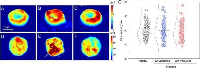 This composite image presents topographical and mechanical analyses of red blood cells (RBCs) infected with Babesia microti. Panels A-C show two-dimensional topographical height profiles. A healthy RBC (A) displays a characteristic biconcave discocyte shape with a central dimple. An infected Bm-RBC with parasite vacuoles (B) shows a loss of this central dimple and an irregular height profile, while an infected Bm-RBC without visible vacuoles (C) largely maintains the donut shape. Panels D-F depict dynamic membrane fluctuations measured by root-mean-square (RMS) height displacement. In panel E, arrows highlight high-value ring-shaped fluctuations surrounding the parasite vacuoles. The color scales indicate height (0-3 μm) and fluctuation (0-80 nm). Panel G is a scatter plot comparing membrane fluctuations (nm) among healthy RBCs, infected RBCs with vacuoles, and infected RBCs without vacuoles. The plot demonstrates that despite structural changes, the mechanical deformability of the host membrane remains statistically comparable across all three groups, a feature that distinguishes Babesia infection from Plasmodium-induced stiffening.