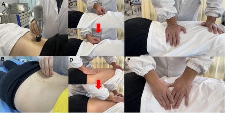 A multi-panel figure illustrating various integrative rehabilitation modalities for lower back pain management. Panel (A) demonstrates Extracorporeal Shock Wave Therapy (ESWT) using a handheld pneumatic applicator applied to the paraspinal lumbar region. Panel (B) shows acupuncture, with thin filiform needles inserted into lumbar acupoints on a prone patient. Panels (C) through (F) depict different Tui-na manual therapy techniques: (C) the rolling technique using the ulnar aspect of a closed fist and forearm; (D) the rubbing technique involving palm-surface contact and longitudinal movement; (E) the kneading technique utilizing rhythmic, circular pressure with the palms; and (F) the plucking technique targeting specific muscle fibers like the erector spinae or multifidus. The figure highlights both modern physical medicine technologies and Traditional Chinese Medicine (TCM) manual and needle-based interventions, emphasizing diverse hand positions, tools, and mechanical forces applied to the lumbar and sacral regions for myofascial relaxation and pain relief.