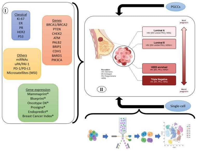 Educational infographic illustrating the classification of breast cancer through various biomarkers and diagnostic approaches. The left panel (I) categorizes breast cancer biomarkers into four domains: 'Classical' (Ki-67, ER, PR, HER2, P53), 'Genes' (including BRCA1/2, PIK3CA, and ATM), 'Gene expression' genomic tests (MammaPrint, Oncotype DX, etc.), and 'Others' (miRNAs, PD-1/PD-L1, MSI). The right panel (II) correlates these markers with the four molecular subtypes: Luminal A (HR+/HER2-), Luminal B (HR+/HER2+/-), HER2-enriched (HR-/HER2+), and Triple Negative (HR-/HER2-), displayed alongside a prognostic arrow ranging from 'Best prognosis' to 'Worst prognosis'. The diagram also includes anatomical cross-sections of the breast and tumor, and introduces emerging technologies like single-cell analysis and PGCCs (Polyploid Giant Cancer Cells) for future classification strategies. This resource is designed for advanced oncology students and clinicians to understand tumor heterogeneity and personalized diagnostic pathways.