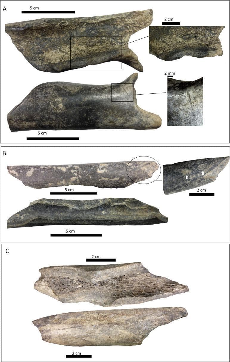 This forensic and pathological diagnostic image displays three distinct sets of bone shaft specimens (A, B, and C) illustrating various fracture patterns and surface modifications. All three specimens exhibit classic spiral fractures, characterized by smooth, twisting break surfaces indicative of torsion or high-energy dynamic forces applied to fresh bone.
Panel A shows a large cortical fragment with magnified views highlighting scoring marks on the cortical face and a distinct internal notch. Panel B displays a longitudinal bone shaft with focal light pitting on the cortical surface (indicated by white arrows) and visible notches on the medullar face. Panel C depicts a more uniform bone fragment with a clearly visible trabecular (cancellous) bone structure alongside the spiral fracture edge.
Educational focus is on forensic taphonomy, identifying ante-mortem or peri-mortem traumatic patterns versus post-mortem modifications. Key visual indicators include pitting, scoring, and notched depressions which help differentiate between mechanical trauma and biological interventions, such as those caused by carnivore scavenging.