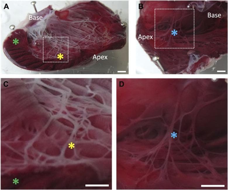 This set of clinical photographs demonstrates the cardiac Purkinje fiber network in a rabbit heart model following chemical ablation. Images A and C show the left ventricle (LV) endocardial surface after exposure to Lugol solution, stained with Triphenyl Tetrazolium Chloride (TTC). In these images, the Purkinje fiber network appears as a prominent white, mesh-like structure (yellow asterisk), indicating widespread cellular necrosis. The underlying bulk myocardium remains largely red (green asterisk), suggesting it is unaffected by the superficial chemical treatment. In contrast, images B and D display the untreated right ventricle (RV) of the same heart. Here, the Purkinje fibers (blue asterisk) stain red/pink, consistent with healthy, viable tissue. The comparison illustrates the specific targeting of the subendocardial conduction system by the chemical agent. The magnified views in C and D highlight the morphological differences between the necrotic, opacified fibers in the treated LV versus the intact, translucent fibers in the control RV. Key anatomical landmarks including the base and apex are labeled for orientation.
