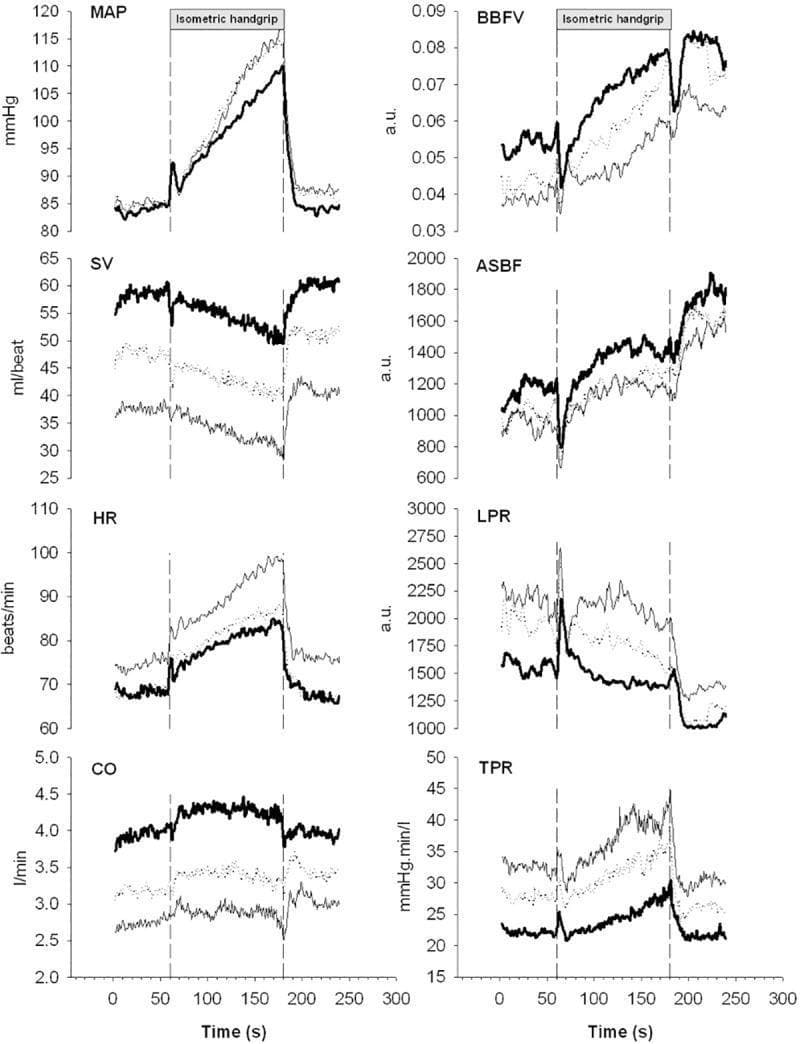 This physiological chart displays a series of eight line graphs illustrating cardiovascular responses in humans (n=11) during a 2-minute isometric handgrip exercise (40% MVC). The graphs represent Mean Arterial Pressure (MAP), Stroke Volume (SV), Heart Rate (HR), Cardiac Output (CO), Brachial Artery Blood Flow Velocity (BBFV), Acral Skin Blood Flow (ASBF), Local Peripheral Resistance (LPR), and Total Peripheral Resistance (TPR) over a 300-second timeline. Each graph compares three physiological conditions: control supine (P1, bold line), mild lower body negative pressure (LBNP -20 mmHg, P4, dotted line), and moderate LBNP (-40 mmHg, P5, hairline). Vertical dashed lines indicate the onset (approx. 50s) and cessation (approx. 200s) of the isometric contraction. Key observations include a progressive rise in MAP, HR, and TPR during the exercise phase across all conditions, with corresponding decreases in SV. The data demonstrates the interplay between central hemodynamics and peripheral vascular resistance in response to combined orthostatic stress (simulated by LBNP) and physical exertion, suitable for exercise physiology and autonomic nervous system education.