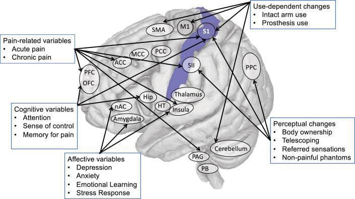 This medical illustration depicts a human brain highlighting the primary somatosensory cortex (S1) and its functional connections within the context of cortical remapping and phantom limb pain. The S1 area is highlighted in purple along the postcentral gyrus. The diagram uses arrows to illustrate the complex interplay between anatomical structures and psychological/behavioral drivers. Key cortical areas shown include the primary motor cortex (M1), supplementary motor area (SMA), secondary somatosensory cortex (SII), and posterior parietal cortex (PPC). Subcortical and limbic structures such as the Thalamus, Amygdala, Hippocampus (Hip), and Periaqueductal Grey (PAG) are also interconnected. Five categorized boxes detail variables influencing S1 organization: 1) Pain-related (acute and chronic); 2) Cognitive (attention, sense of control, memory); 3) Affective (depression, anxiety, stress response); 4) Use-dependent (intact arm or prosthesis use); and 5) Perceptual (body ownership, telescoping, referred sensations). This diagram serves as a conceptual model for neuroplasticity and the multi-factorial nature of chronic pain syndromes.