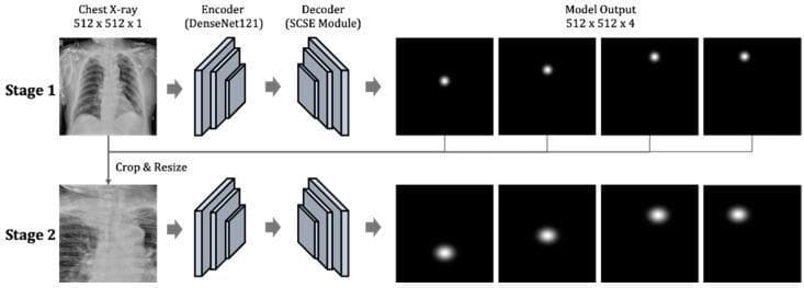 A technical diagram illustrating a two-stage deep learning architecture for key point detection in chest radiography, specifically designed to evaluate endotracheal tube (ETT) positioning. Stage 1 takes a full-field chest X-ray (512x512x1) as input, passing it through a DenseNet121 encoder and a decoder with a Spatial and Channel Squeeze & Excitation (SCSE) module. The output is a set of four heatmaps representing the initial localization of four clinical key points: the tracheal tube end, the carina, and the left and right clavicular heads. In Stage 2, the process is refined by cropping and resizing the region of interest based on Stage 1 results, passing it through identical encoder-decoder blocks to produce high-resolution probability distributions of the target coordinates. The model facilitates clinical assessment by calculating distances between these anatomical landmarks to determine if the ETT position is appropriate (typically 20–70 mm from the carina). This tool is intended for medical AI research and radiology computer-aided diagnosis training.