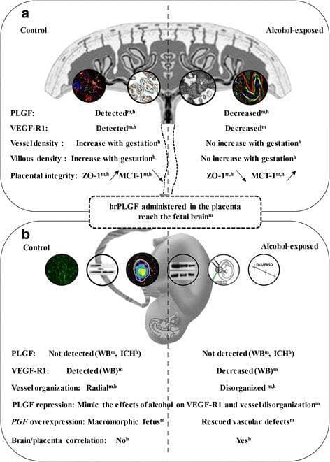 A multi-panel pathophysiology diagram summarizing the comparative effects of in utero alcohol exposure on the placenta (Section A) and fetal brain (Section B) in humans and mouse models. Section A illustrates the placenta, contrasting control and alcohol-exposed states. In the alcohol group, there is a decrease in placental growth factor (PLGF) and VEGF-R1 expression, no gestational increase in vessel or villous density, and impaired placental integrity evidenced by decreased ZO-1 and increased MCT-1 levels. Section B depicts the fetal brain, showing that alcohol exposure leads to decreased VEGF-R1 levels and a shift from radial to disorganized cortical vessel organization. Central to the diagram is the pathway demonstrating that recombinant human PLGF (hrPLGF) administered to the placenta can reach the fetal brain. Experimental results shown include Western blot (WB) and immunohistochemistry (IHC) data indicating that placental PGF repression mimics alcohol's effects on brain vasculature, while PGF overexpression can rescue these defects. The diagram highlights a positive correlation between vascular placental and brain defects in human alcohol-exposed groups, emphasizing the placenta's role in fetal alcohol spectrum disorders (FASD).