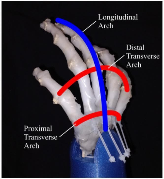 This anatomical illustration and clinical specimen photograph depicts the functional skeletal arches of the human hand, demonstrated on a 3D-printed biomimetic prosthetic model. The image highlights the three-dimensional structural architecture essential for palm cupping, manual dexterity, and grasping adaptability. Three primary arches are overlaid with color-coded annotations: 1) The Longitudinal Arch (blue), which follows the long axis of the third metacarpal and finger; 2) The Proximal Transverse Arch (red), a relatively fixed arch located at the level of the carpus and proximal metacarpals; and 3) The Distal Transverse Arch (red), a mobile arch spanning the metacarpal heads. The specimen is mounted on a blue base with visible actuation lines representing synthetic tendons. This visual is used to teach hand biomechanics and kinesthetically informed design in prosthetics and orthopedic surgery, focusing on how these skeletal relationships allow the palm to adjust its concavity to accommodate objects of various shapes and sizes.