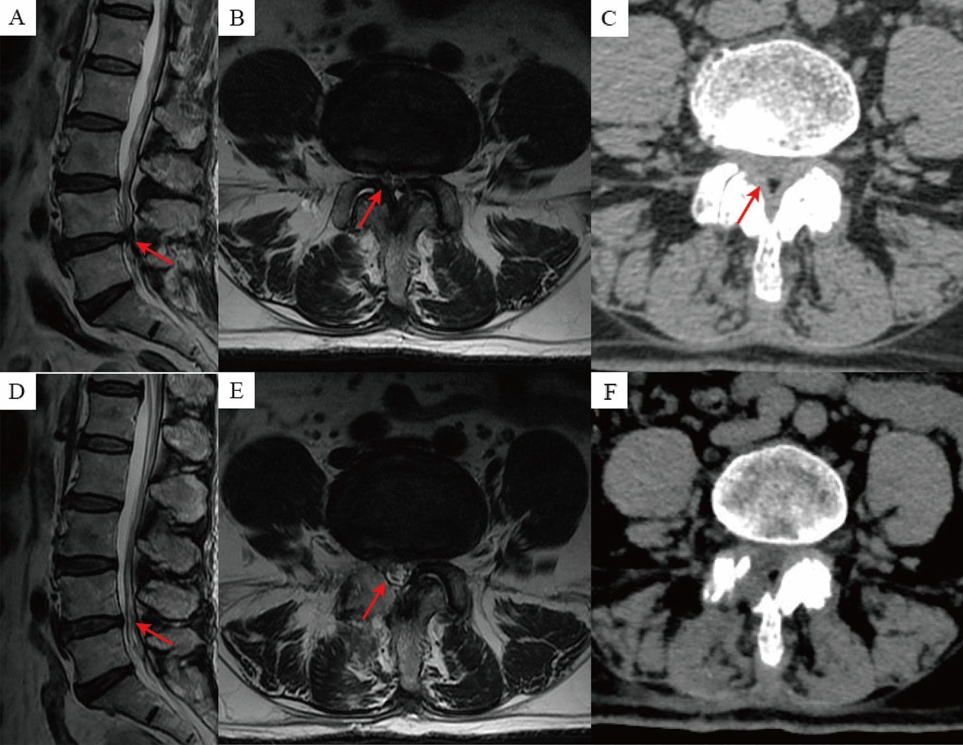 Hugging Face pmc clinical VQA raw