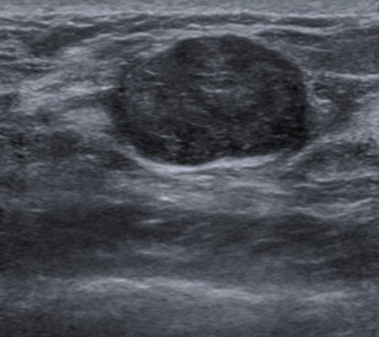 Hugging Face pmc clinical VQA raw