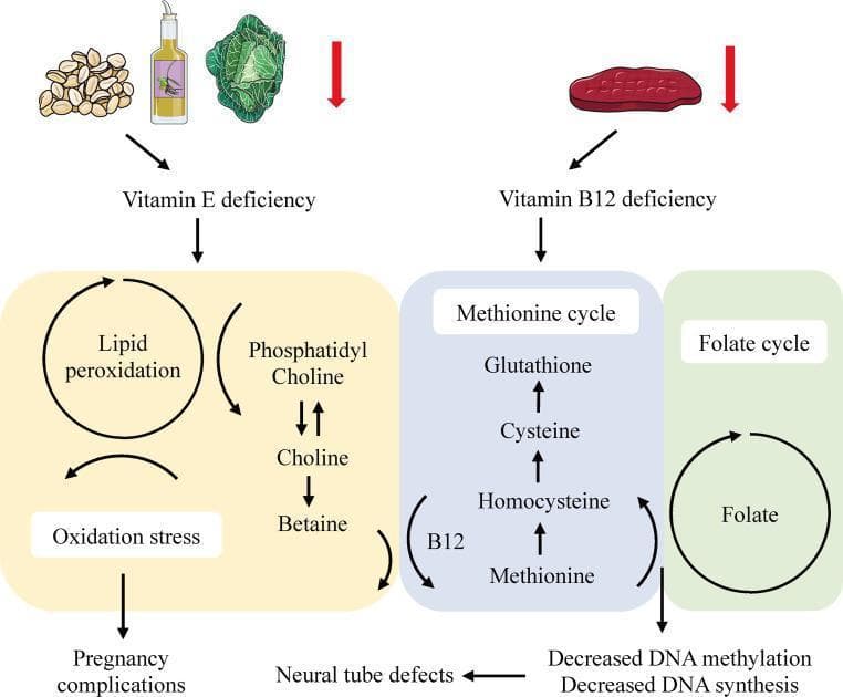 A pathophysiology diagram illustrating the systemic effects of Vitamin E and Vitamin B12 deficiencies on lipid peroxidation, one-carbon metabolism, and associated pregnancy complications. The diagram is divided into two primary functional pathways: 1. Vitamin E Pathway (yellow-shaded area): Depicts dietary sources (nuts, oil, leafy greens) leading to a deficiency state. This state triggers lipid peroxidation and oxidative stress, involving the Phosphatidyl Choline-Choline-Betaine pathway. The ultimate clinical consequence shown is pregnancy complications. 2. Vitamin B12 and Folate Pathway (blue and green shaded areas): Shows a deficiency originating from meat-based sources. It illustrates the 'Methionine cycle' where B12 acts as a cofactor in the conversion of Homocysteine to Methionine. The pathway also includes Cysteine and Glutathione production. The 'Folate cycle' is shown adjacent, contributing to DNA health. Impairment in these cycles due to B12 deficiency leads to decreased DNA methylation and decreased DNA synthesis, which are linked to the development of neural tube defects. The diagram serves as an educational summary of micronutrient biochemistry and its relevance to maternal-fetal health and clinical obstetrics.